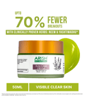 Acne Clear Off Gel - Arish Bionatural