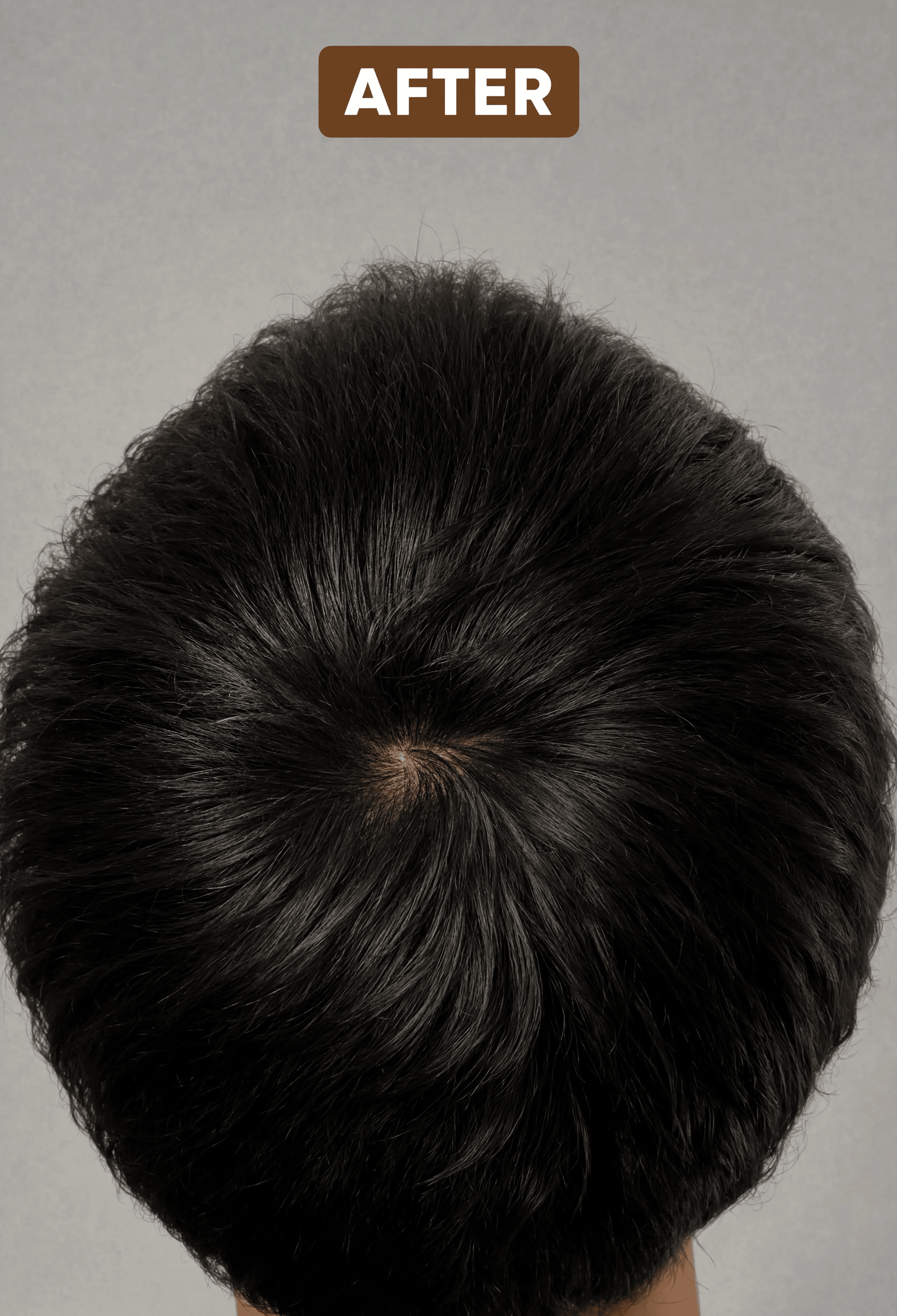 Hair Vita - Arish Bionatural