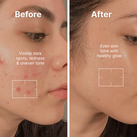 Haldi Neem Face Wash - Arish Bionatural